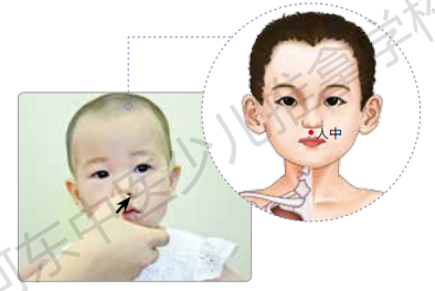孩子突然休克,掐人中来救急