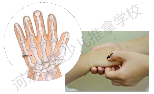 孩子突然休克,掐人中来救急